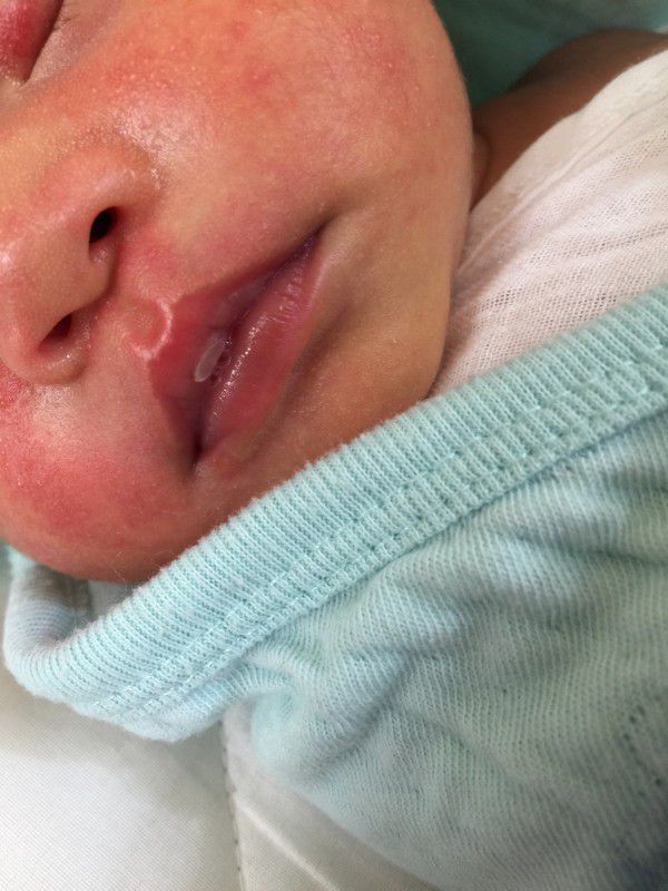 喝完奶 嘴脣上白白的