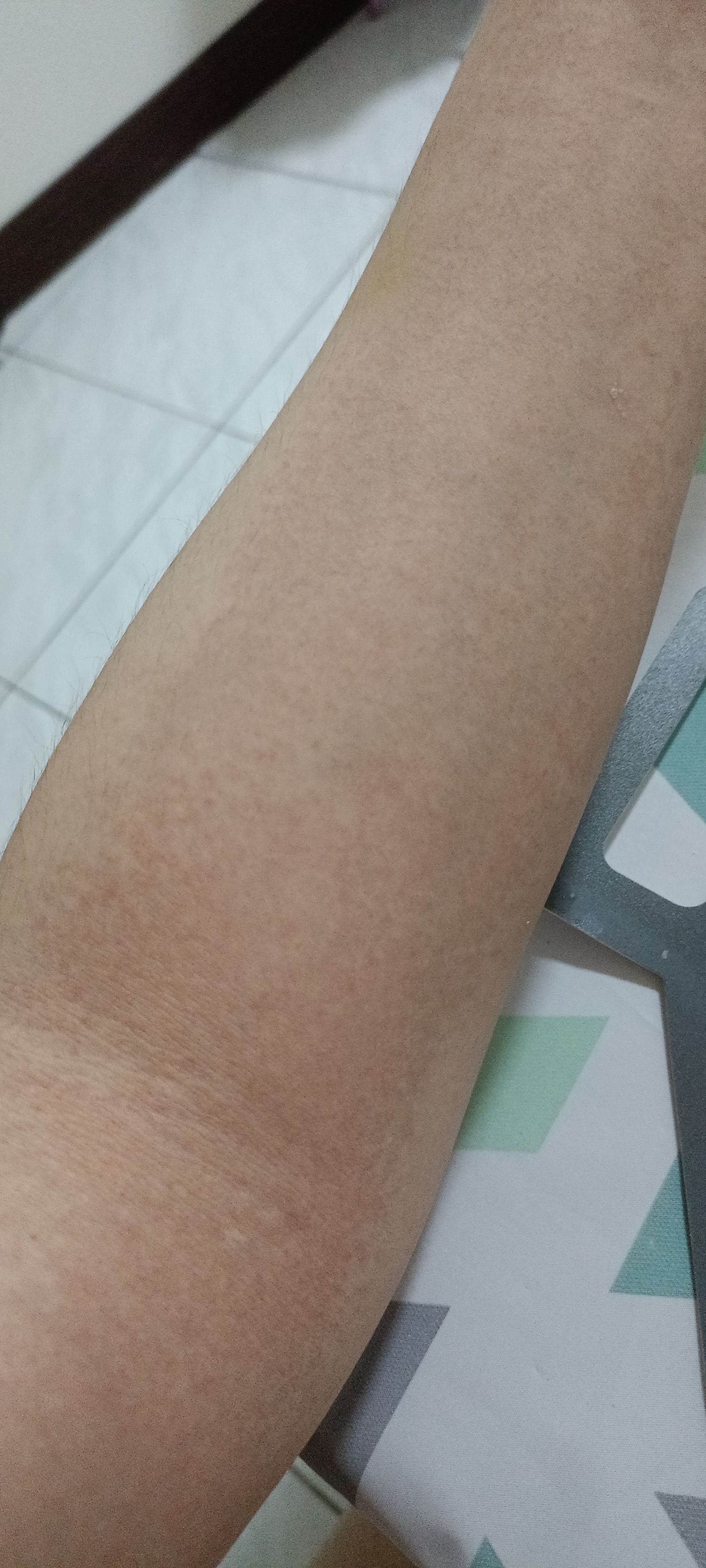 產後皮膚長小紅疹