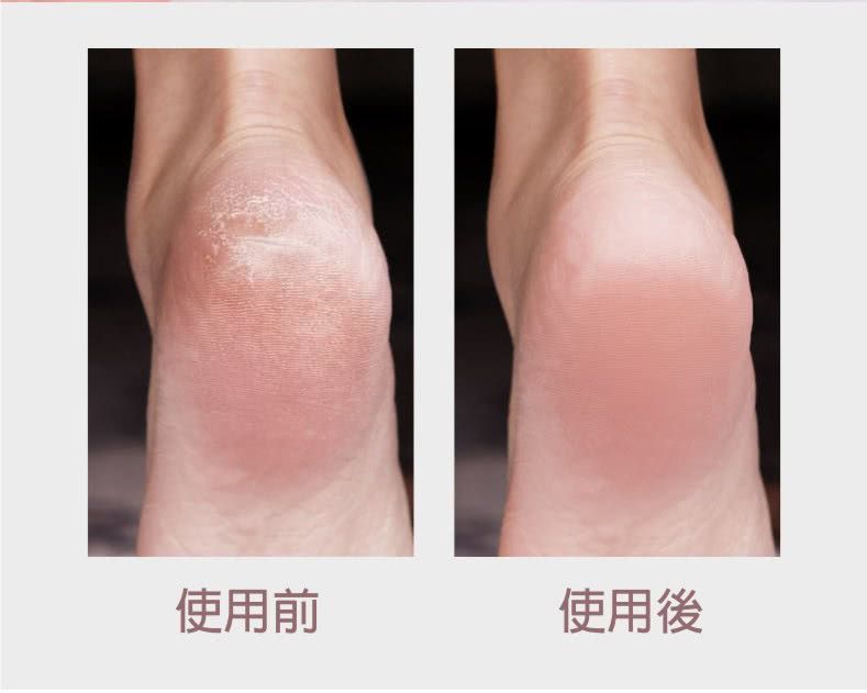 MKS美克斯 - 真空吸塵充電電動磨腳皮機(NV8615B)-白