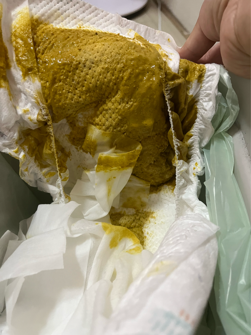 快4個月的寶寶大便這樣