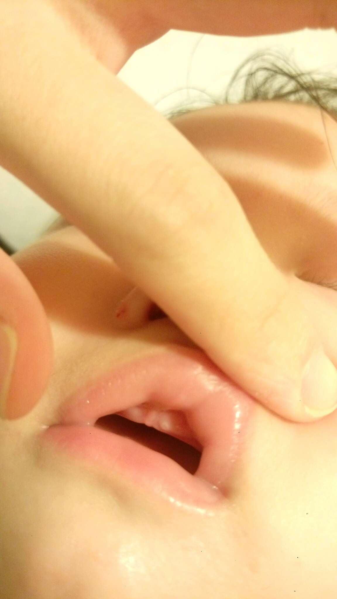 寶寶牙齦