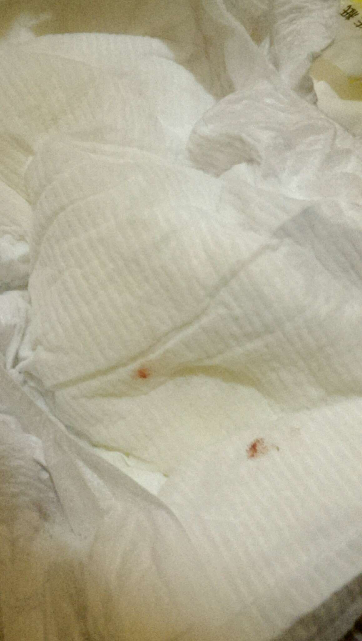 為什麼尿布上會有血？