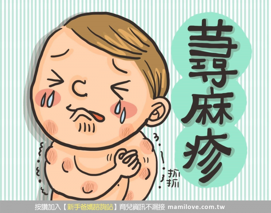 寶寶蕁麻疹，原來是感染害的！
