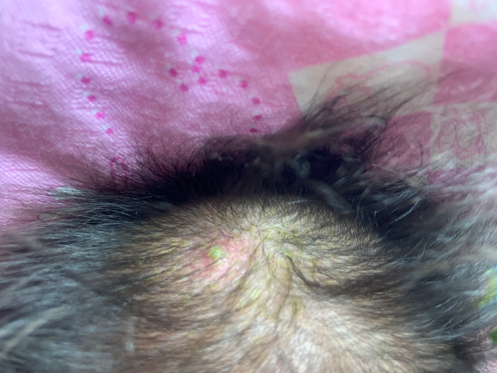 女兒頭頂的乳痂紅腫