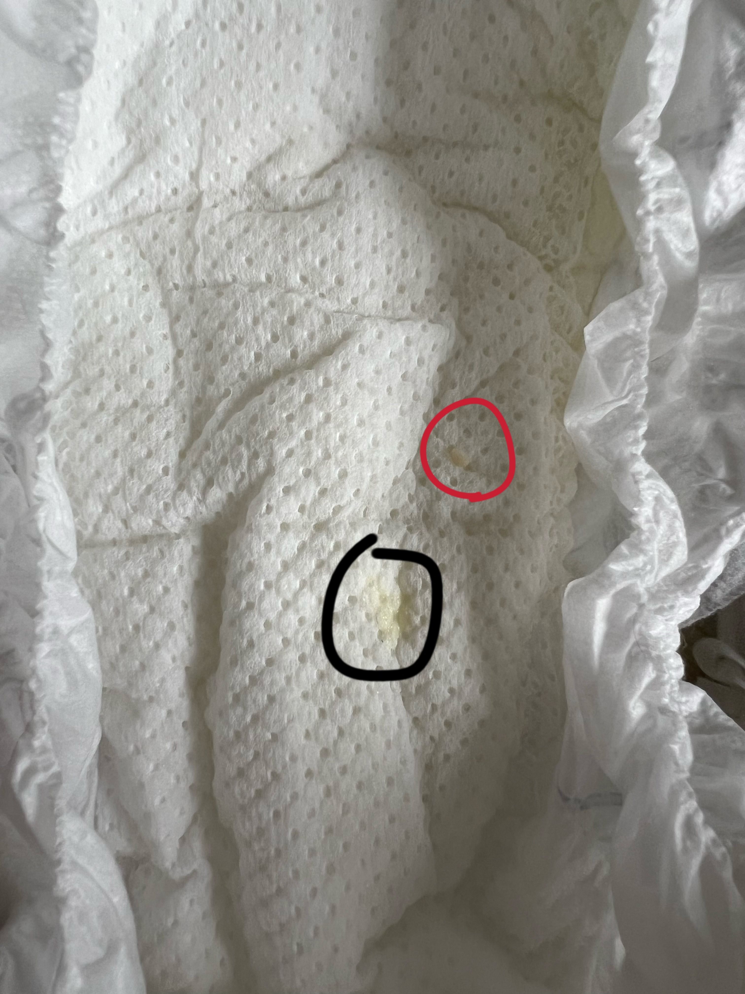 女寶尿布黃色分泌物