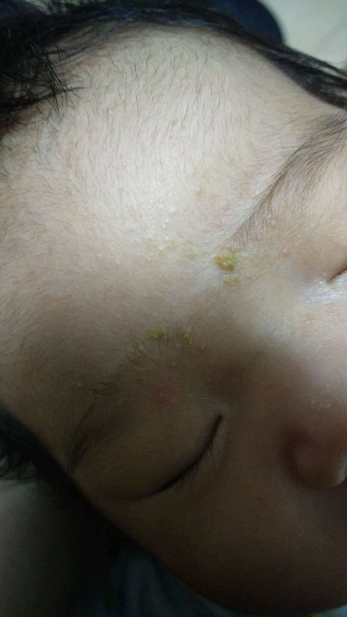 寶寶眉頭綠綠的怎麼了