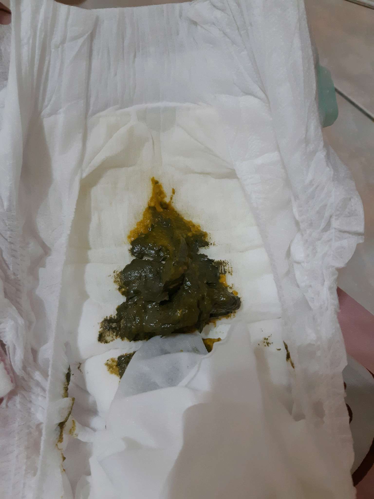 這樣大便真的正常麻 ???