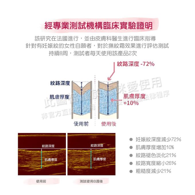 德國珊諾sanosan - S孕女神寵愛孕肌撫紋組-植萃抗紋護理油+多胜肽緊緻撫紋霜