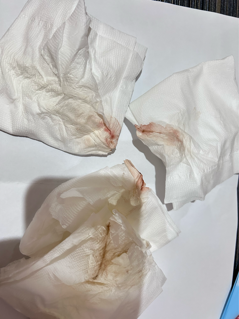 想問各位媽咪們這樣是著床出血嗎（內有圖片