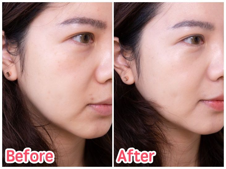 打造無瑕光澤肌！韓國 Age 20's 爆水粉餅