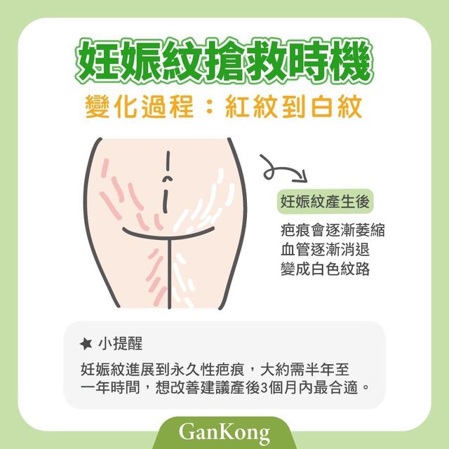 1.肚子真的不能大太快
2.要吃膠原蛋白增加皮膚彈性
3.每天洗完澡要擦妊娠油或霜保養