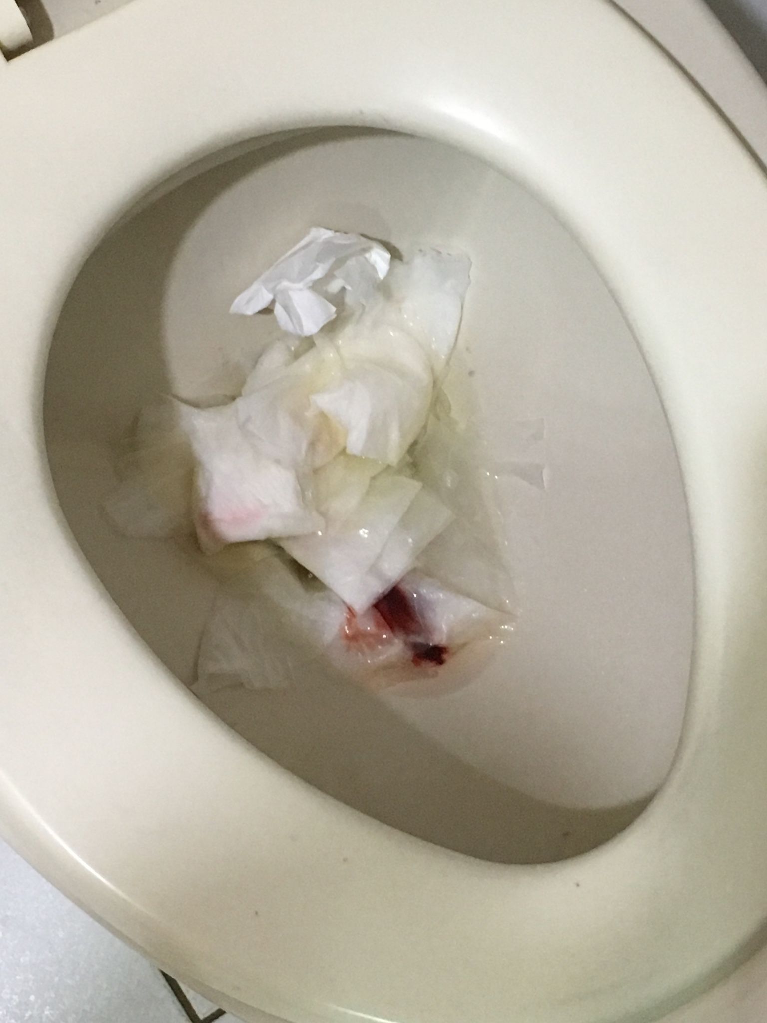 請問這樣落紅是還好嗎？(ps圖片有點噁心）