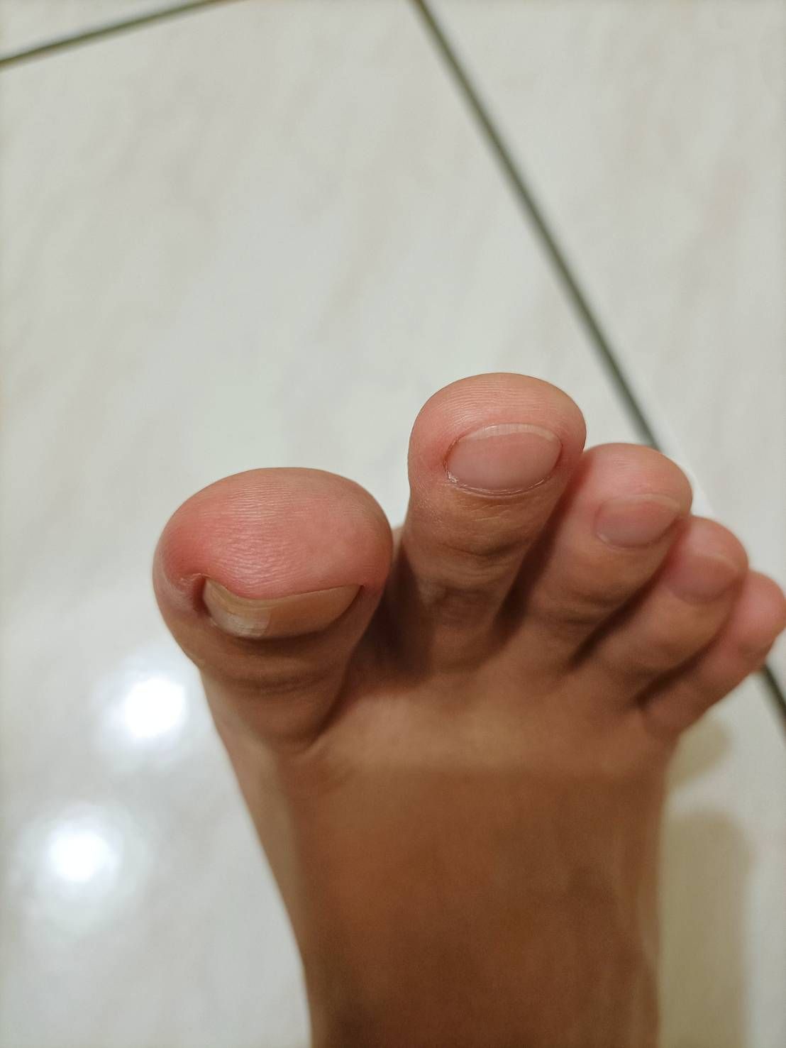 請問新竹有沒有診所有在做3TO指甲矯正?