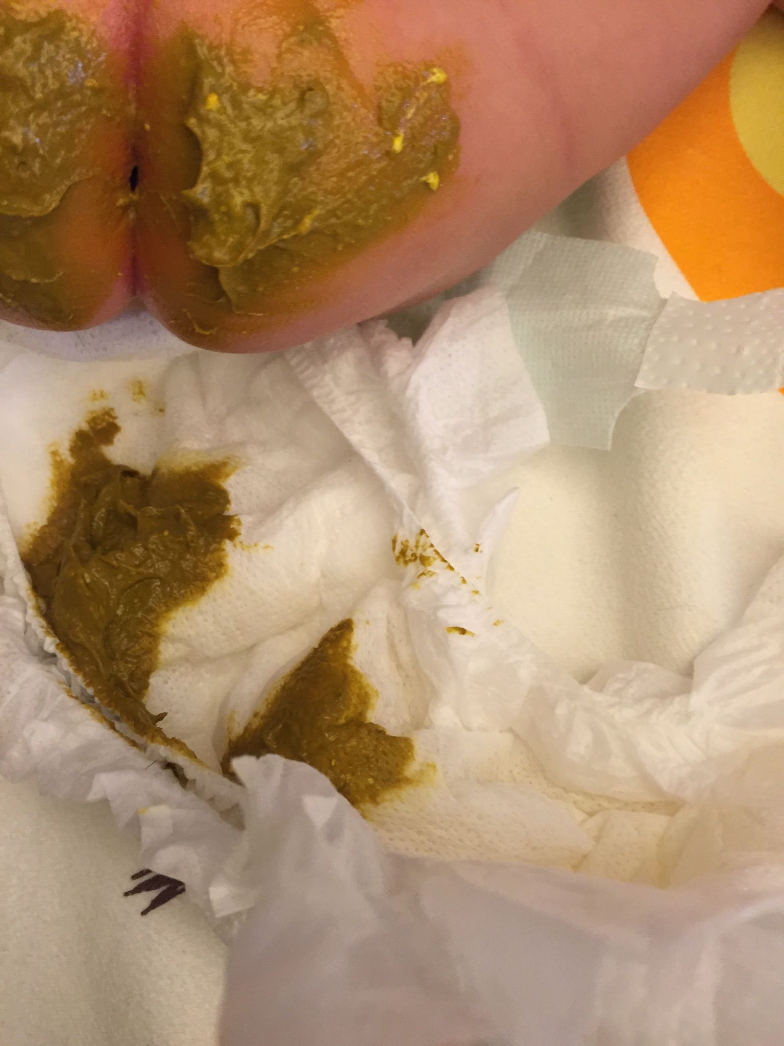 寶寶便便有白白的