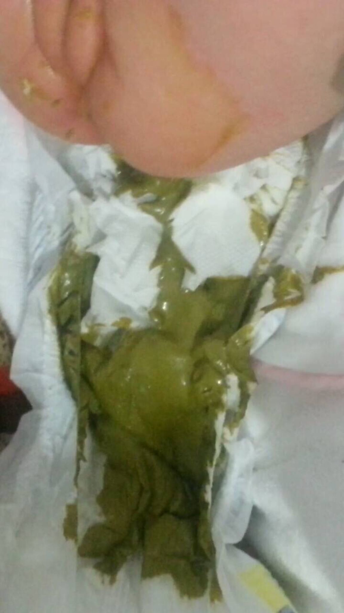 喝明治一階奶粉的大便