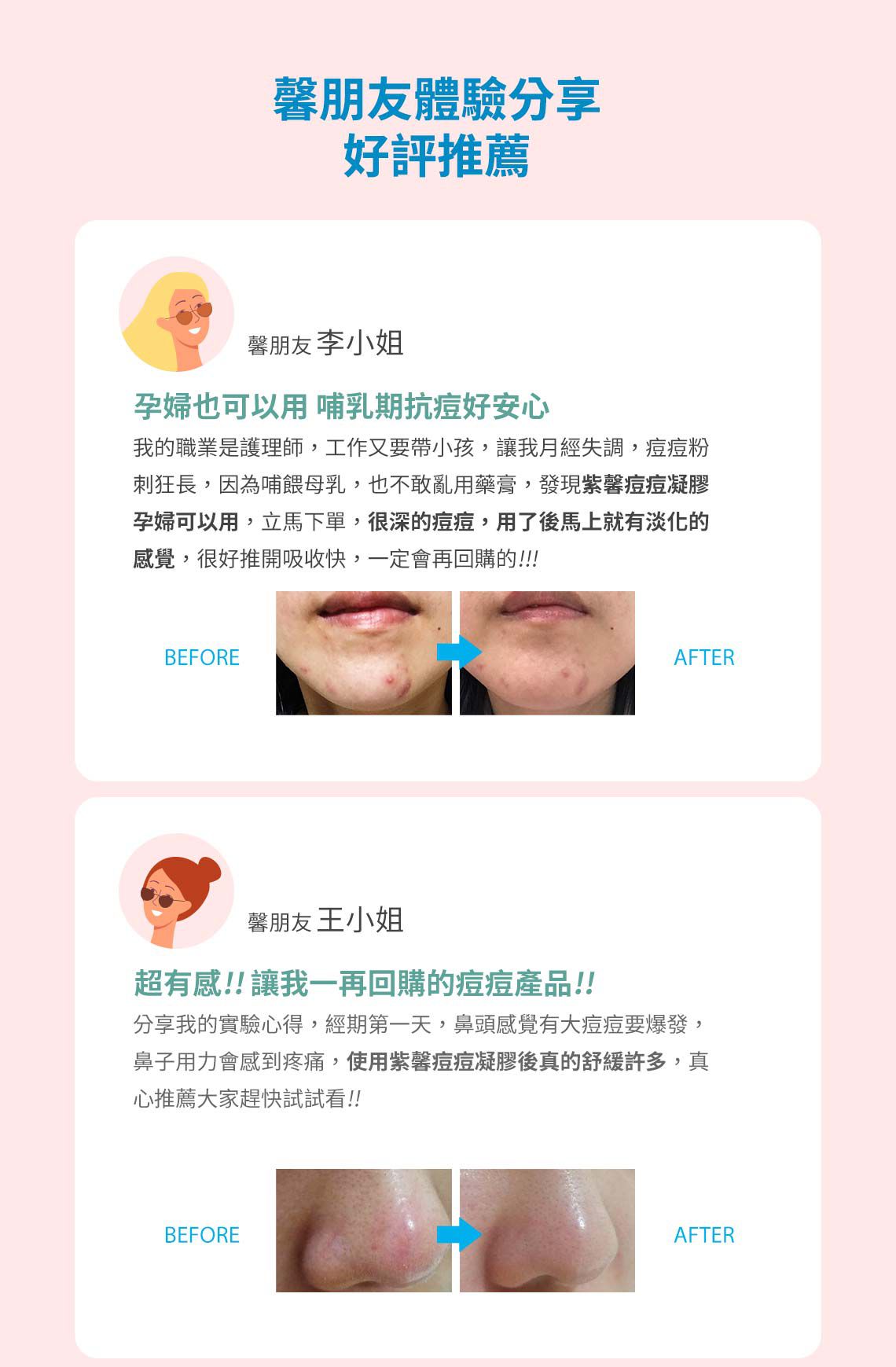 Cindora 馨朵拉 - 紫馨痘痘凝膠-10g