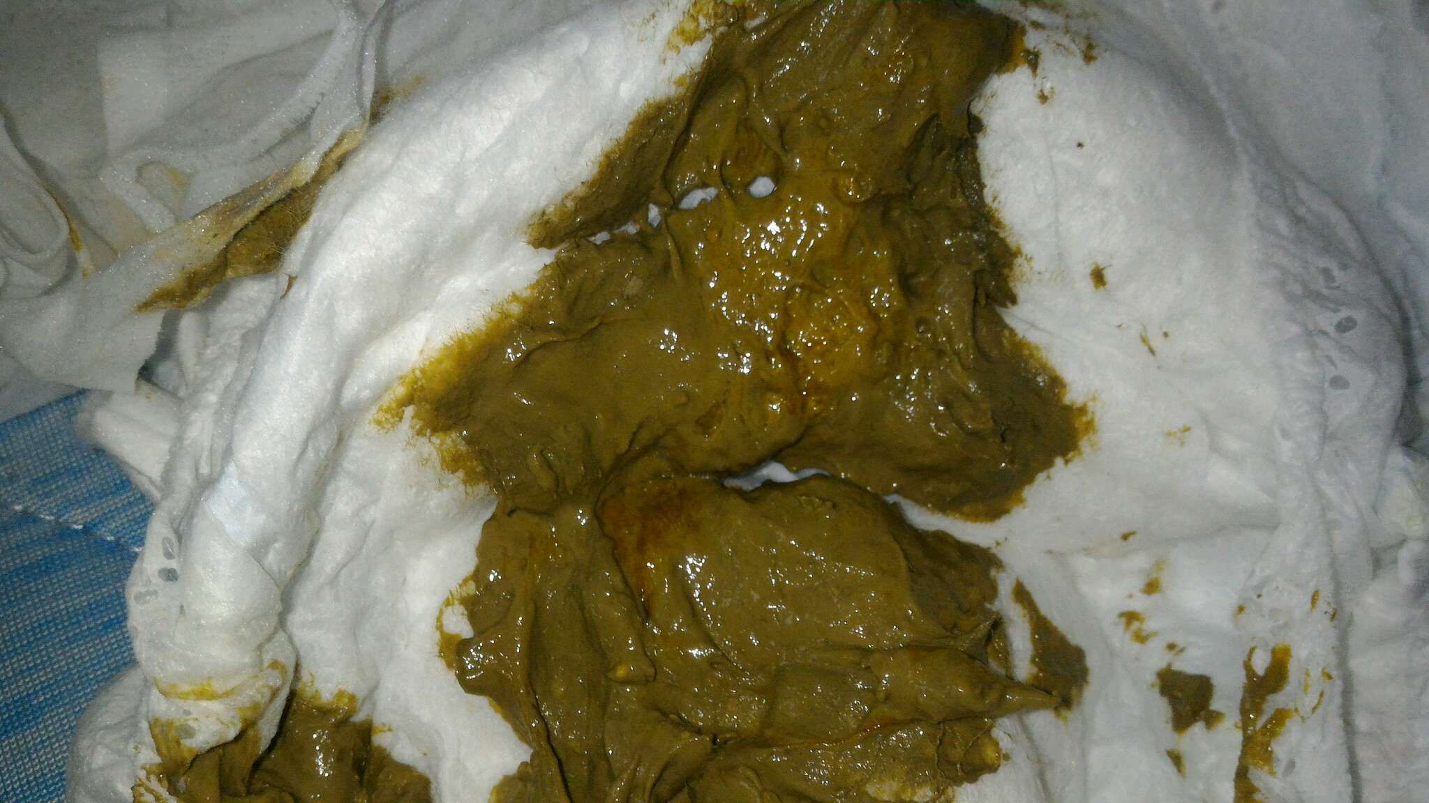 便便帶有咖啡色的顏色