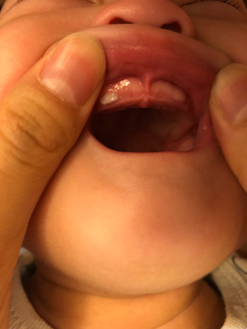 長牙先長兩顆側門牙