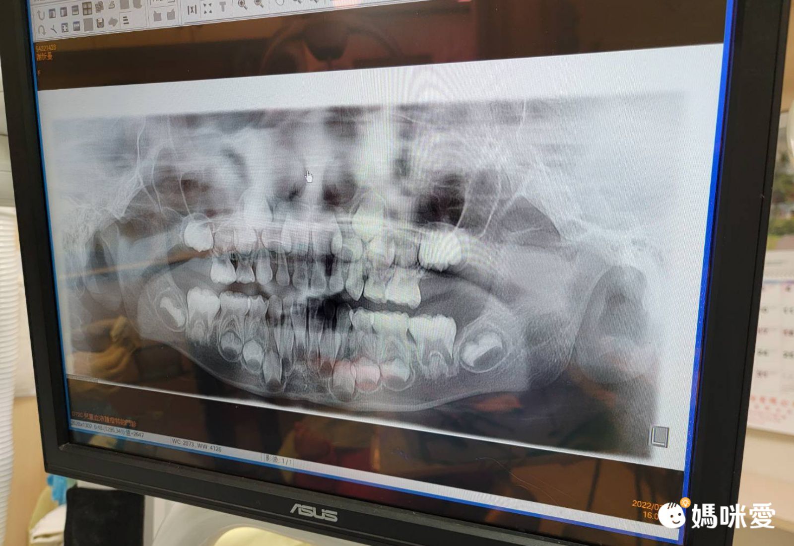 紀念每一次掉牙【乳牙收藏盒】大賞 ♡ 台灣製MangoBanana