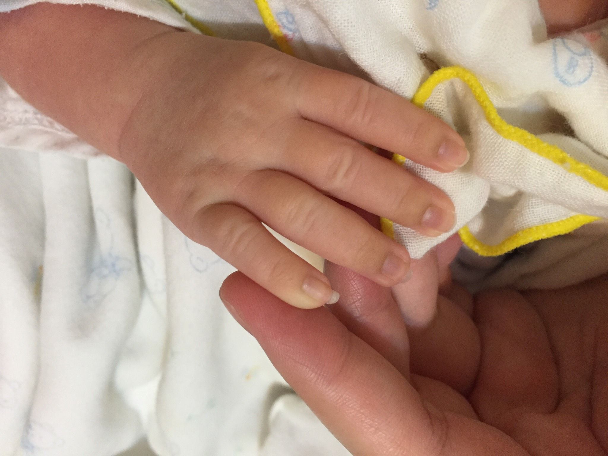 新生兒手指頭沒血色請問正常嗎？