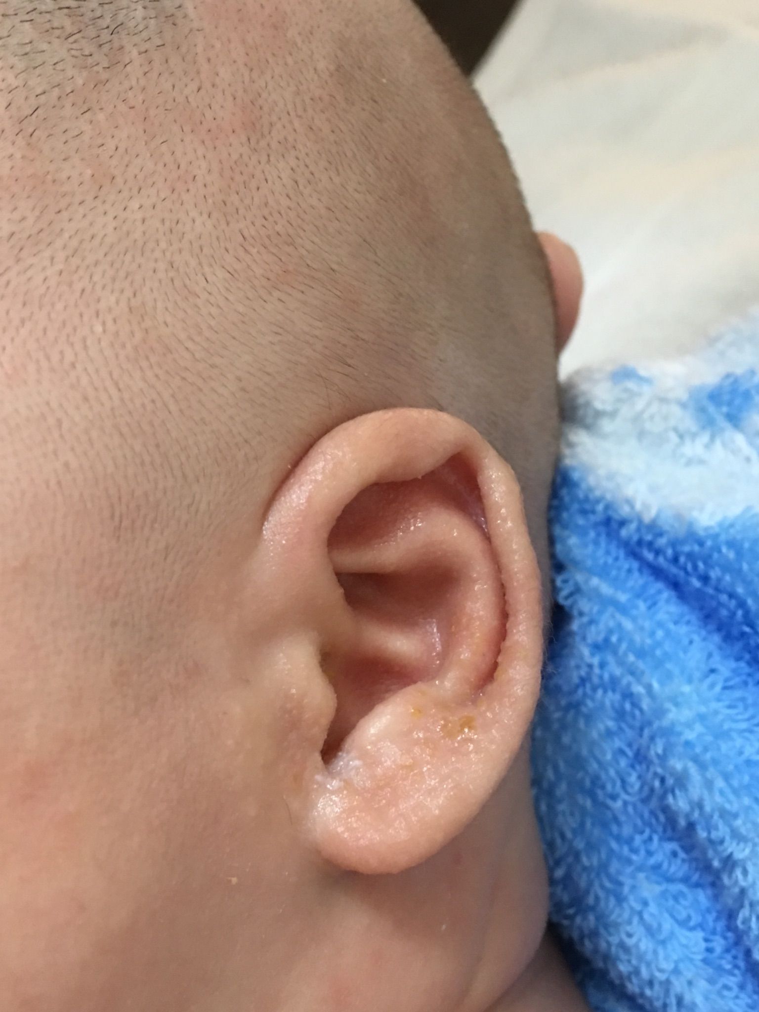 請問耳朵怎麼了⋯⋯⋯