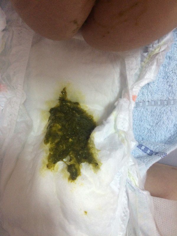 吃蘋果泥便便會變綠色，但⋯