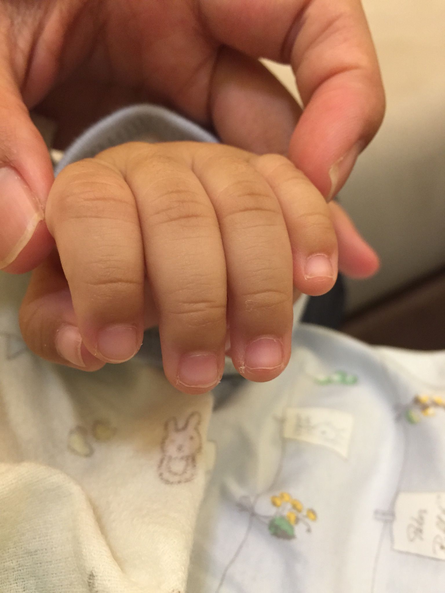 寶寶的指甲邊緣