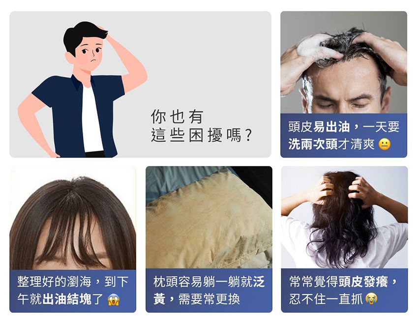 3ZeBra - 【針好嚕】頭皮按摩滾輪-銀色