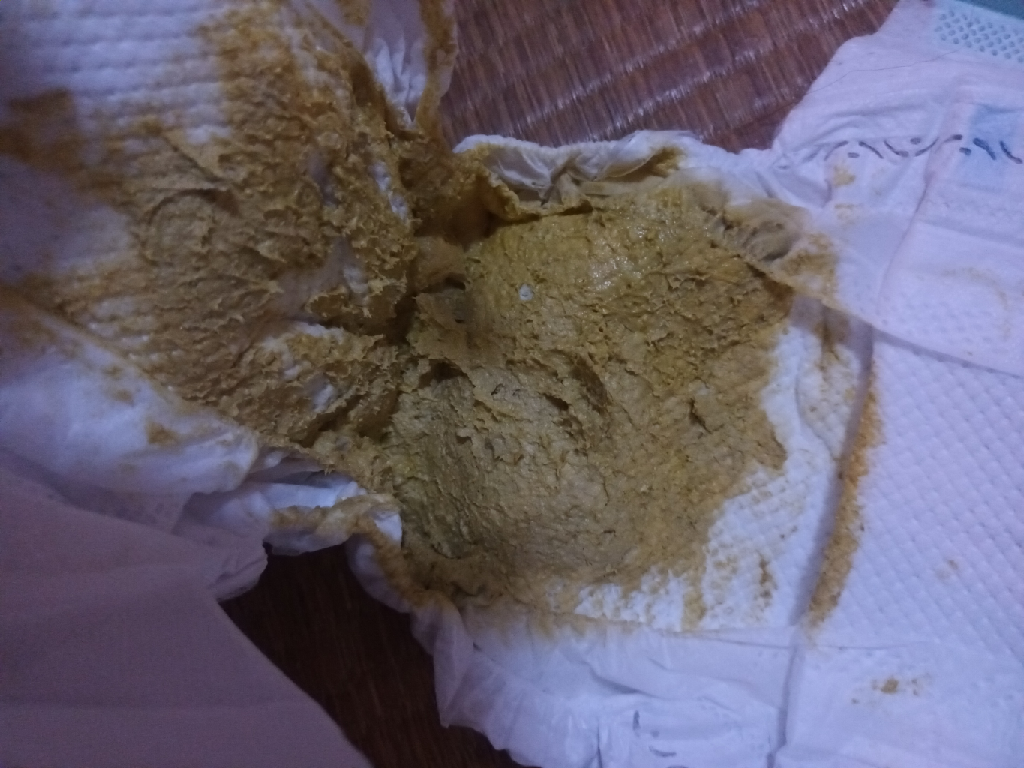 寶寶3個月這樣大便顏色正常嗎？