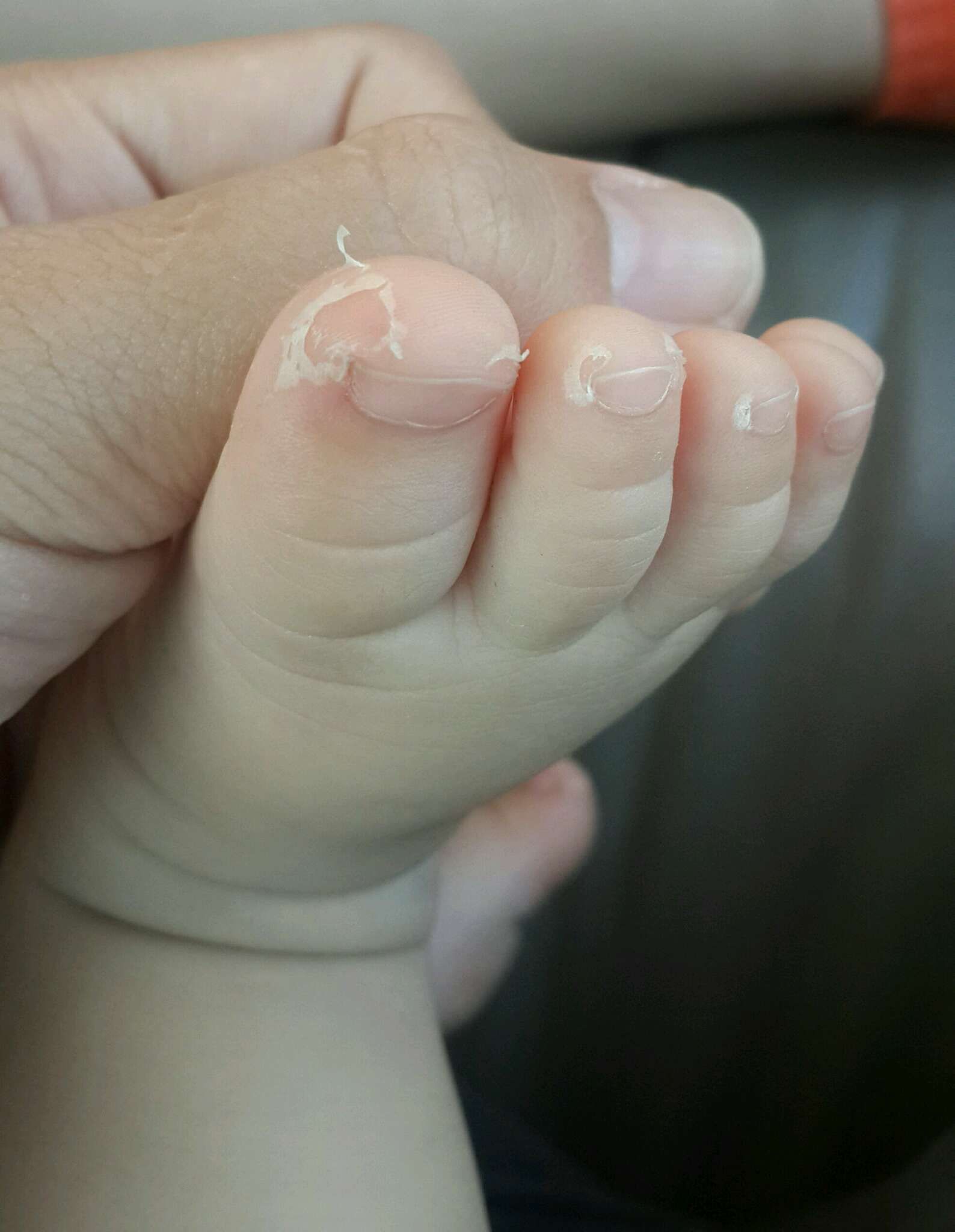 怎麼會這樣呀？