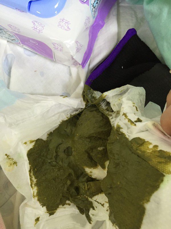 寶寶大便突然變綠色