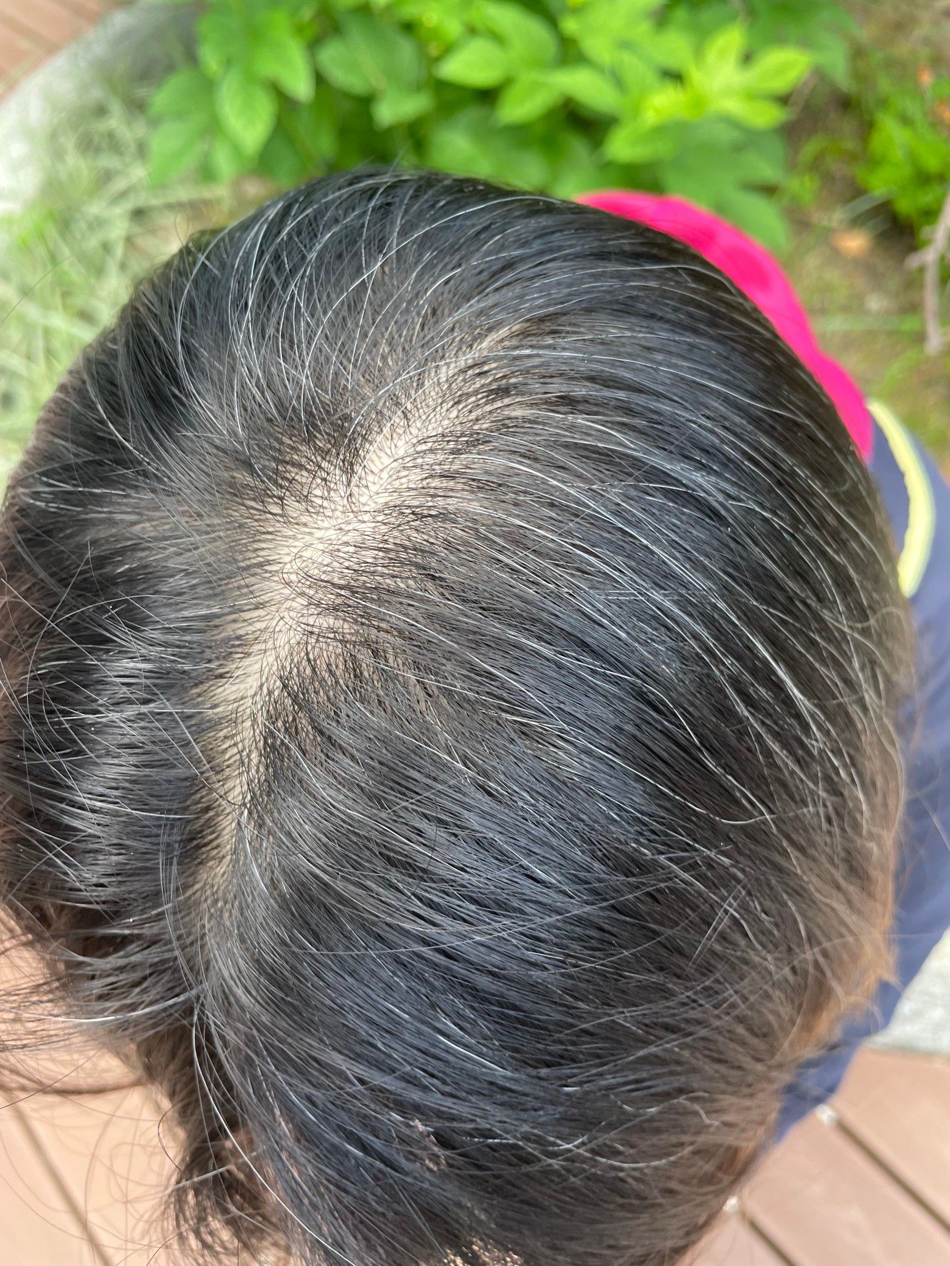 最高現折$600!!【髮速黑｜美吾髮植優】孕婦哺乳可用