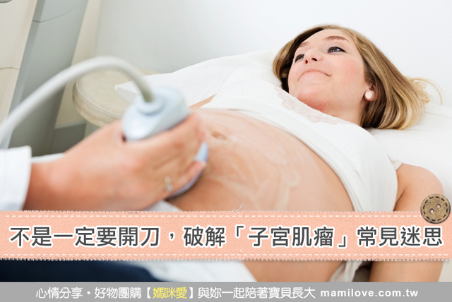不是一定要開刀，破解「子宮肌瘤」常見迷思