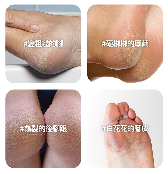 韓國 F3 systems - 安全設計足部去角質刮刀(2入組)