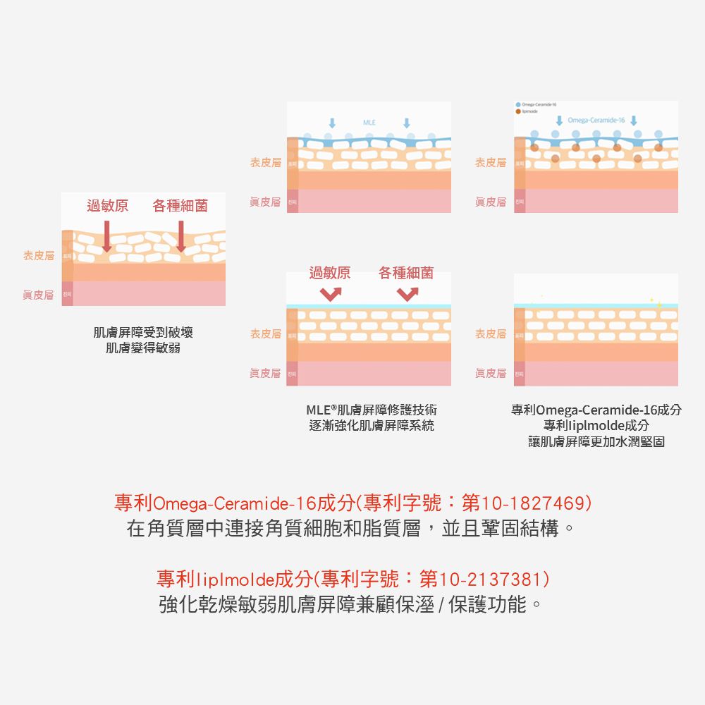 ATOPALM 愛多康 - B5高效保濕修護乳液180ml