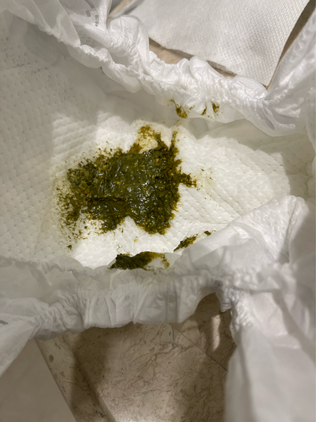 急！求解！請問這樣顏色的大便正常嗎？