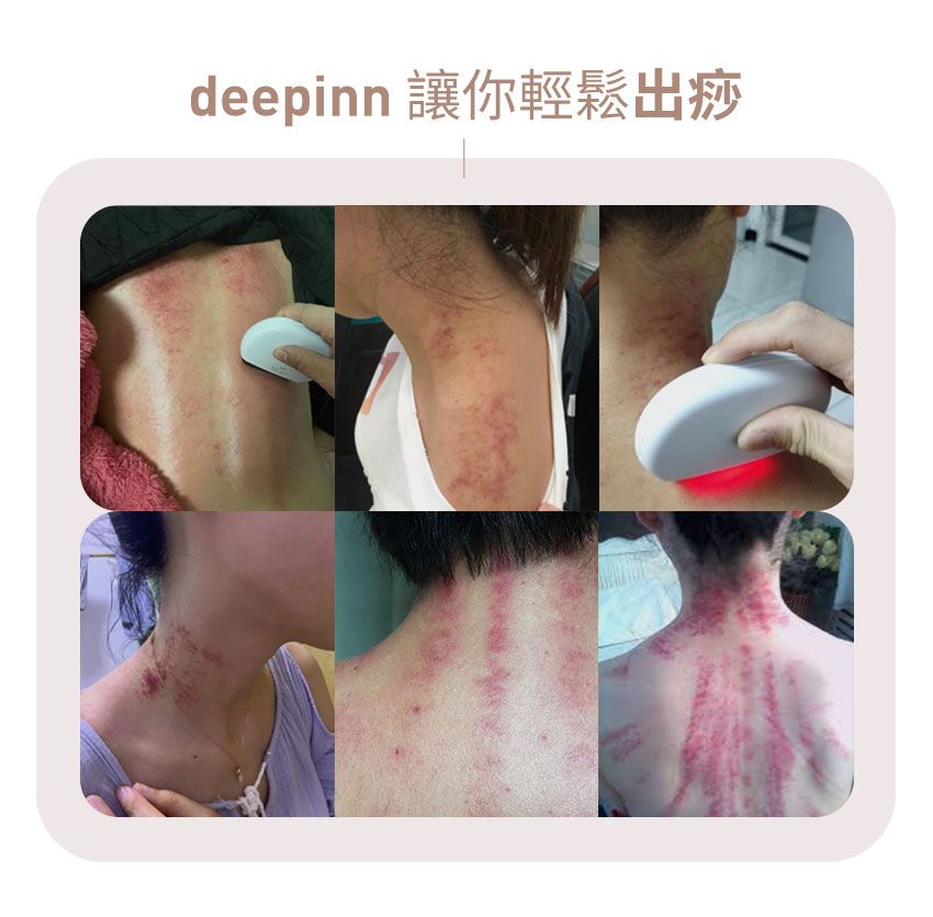 3ZeBra - deepinn 砭石溫感按摩儀/刮痧儀-白色