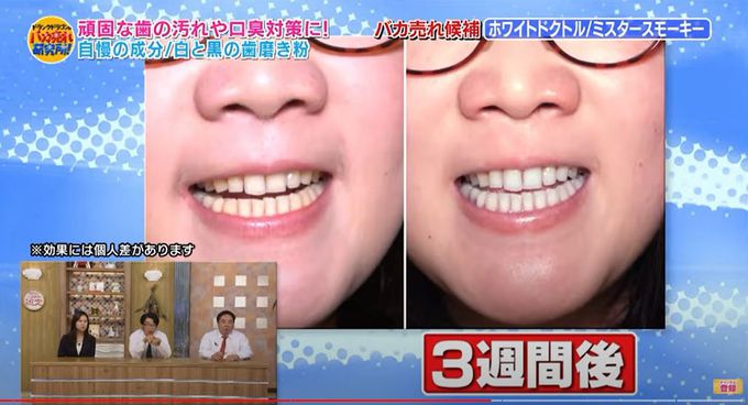 日本神戶製藥 - 丁子屋喜左衛門 強效潔牙粉-幾何圖騰(黑)