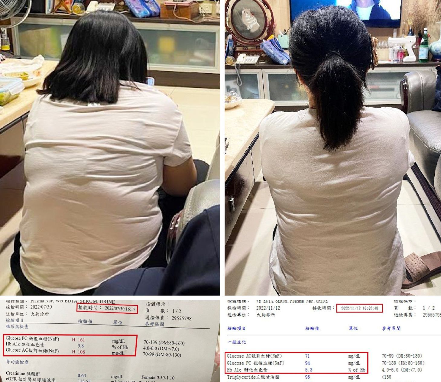 減掉20公斤的減重方法～台北桃園胃肉毒心得分享