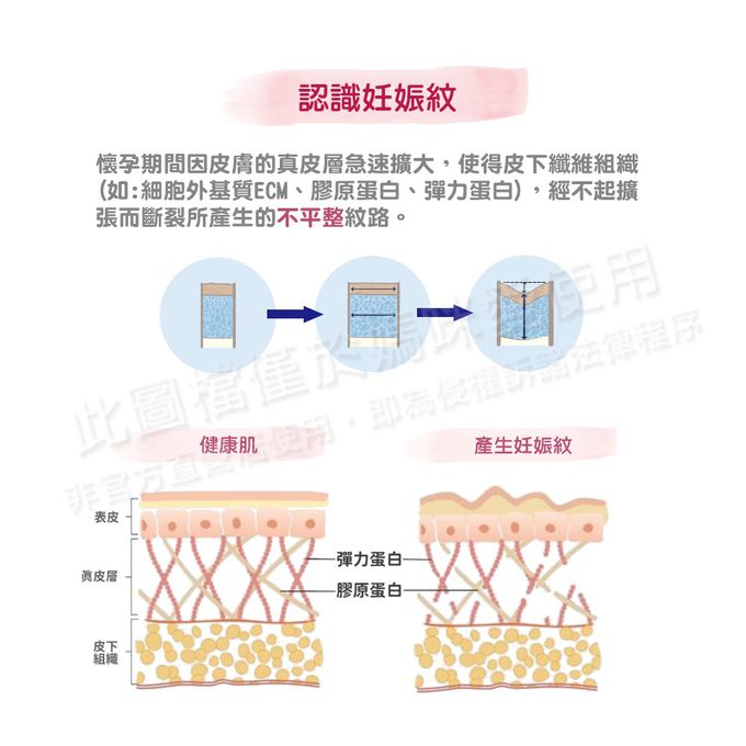 德國珊諾sanosan - S孕女神膠原彈力抗紋霜-200ml
