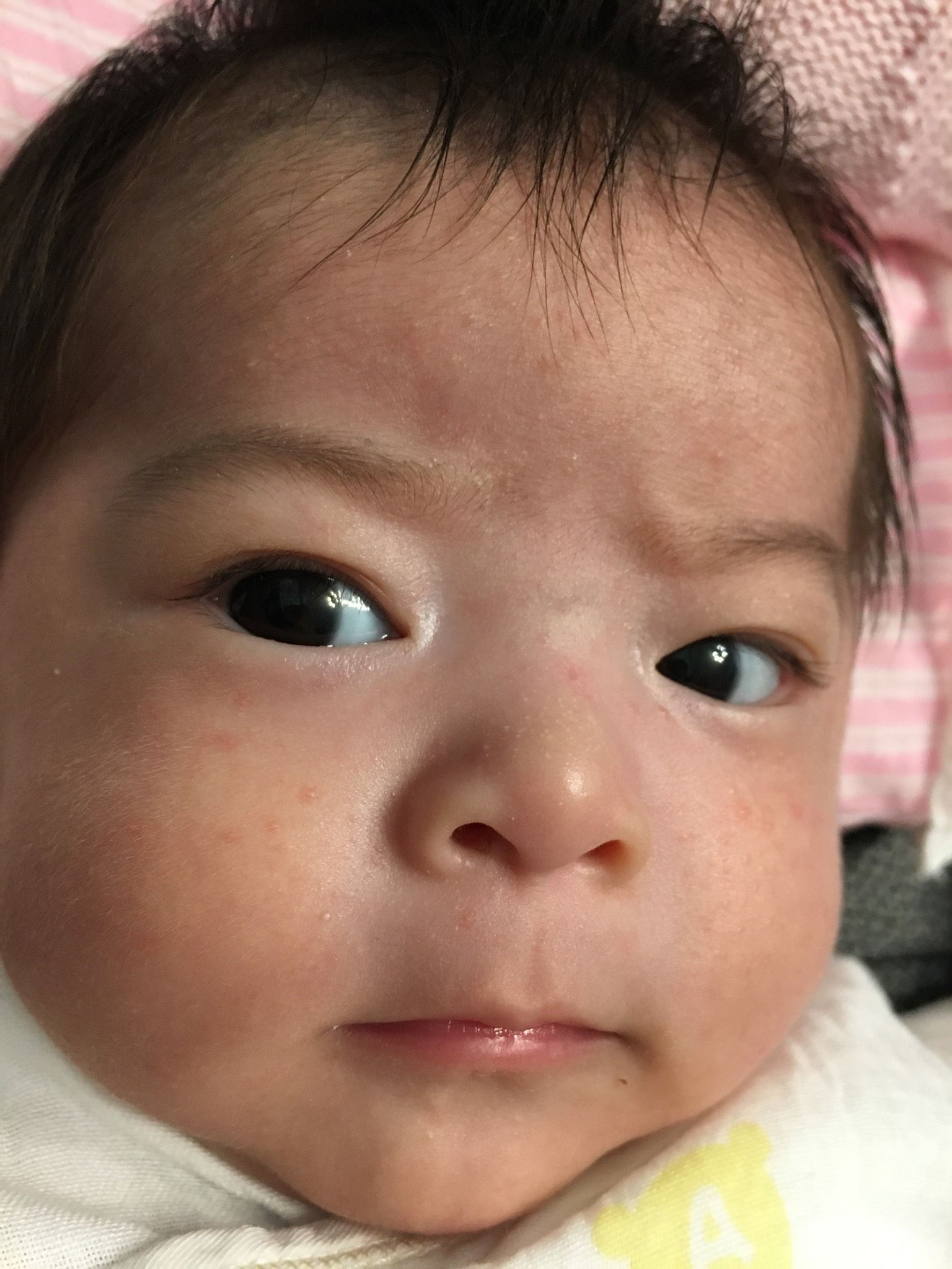 還沒兩個月的寶寶 臉上有一粒一粒的