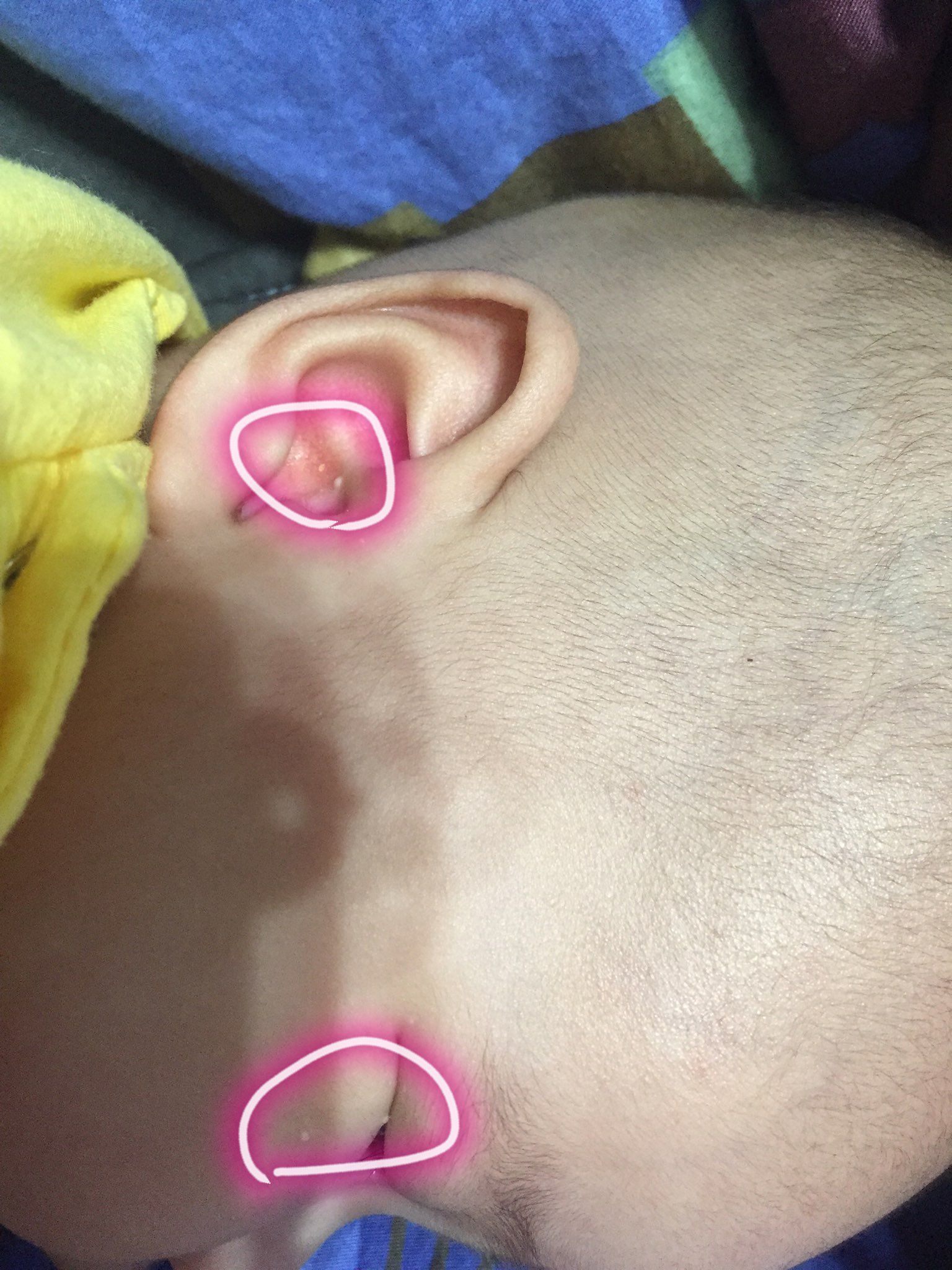 一顆一顆白白的是什麼