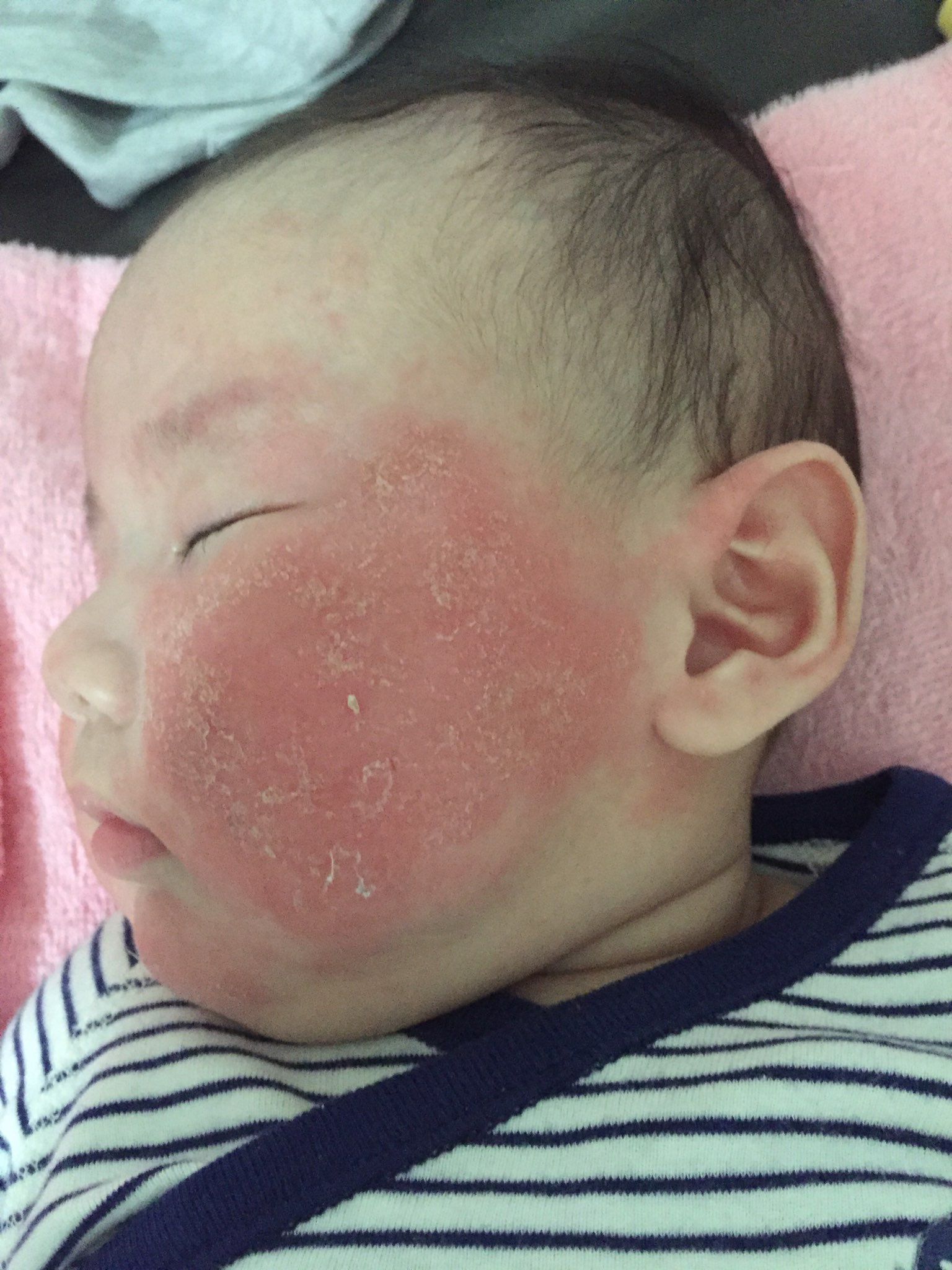 有推薦在台北看寶寶皮膚厲害的皮膚科醫生嗎???