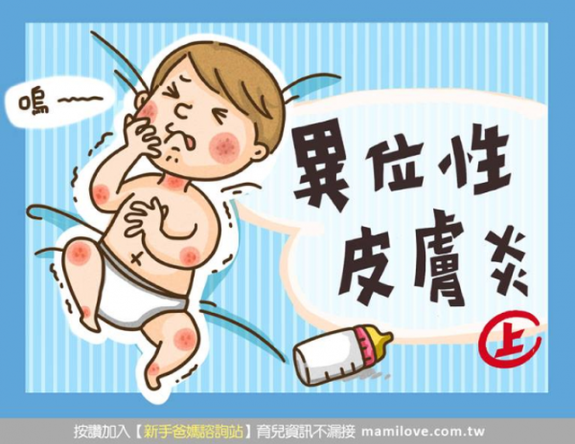 異位性皮膚炎特輯：(上) 讓我們來認識異位性皮膚炎