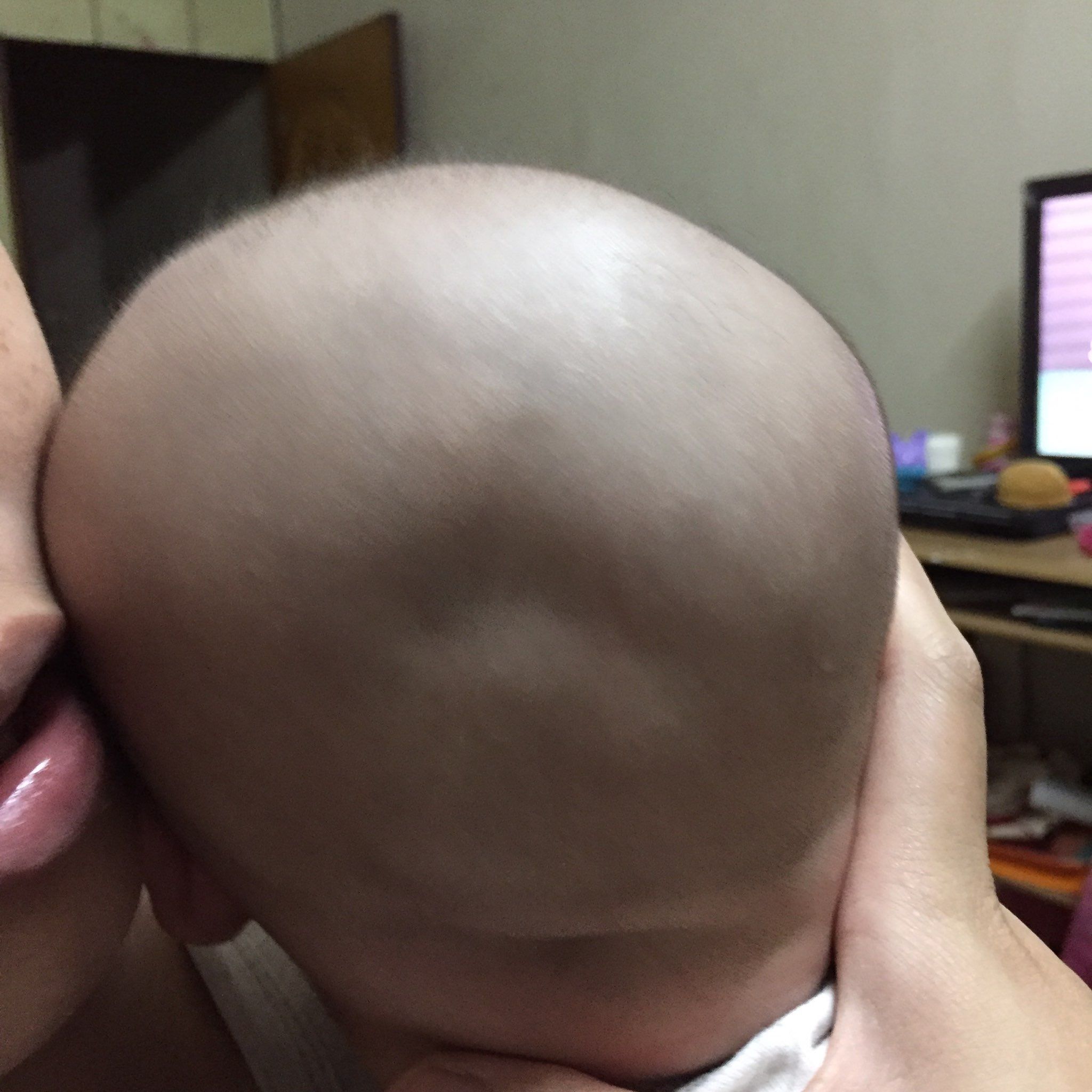寶寶頭型