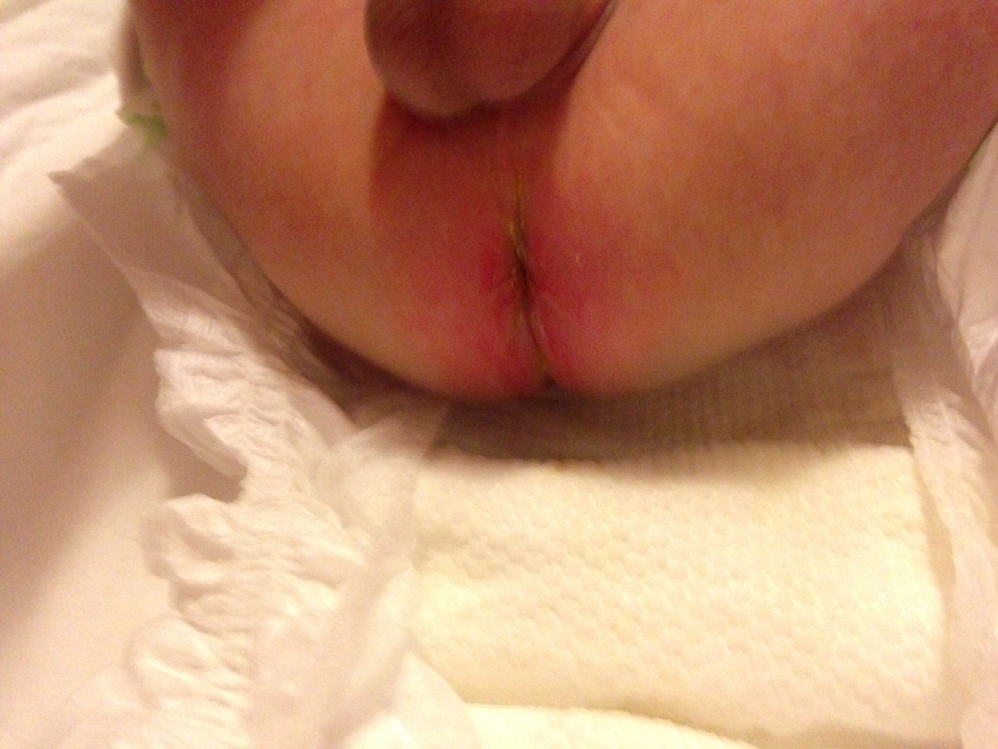 寶貝紅屁股怎麼半已經半個月了