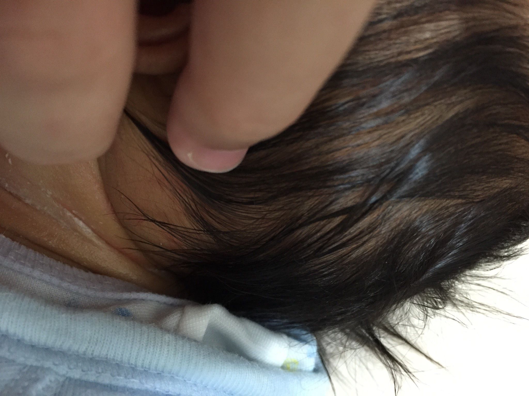 如何清除皺折奶垢