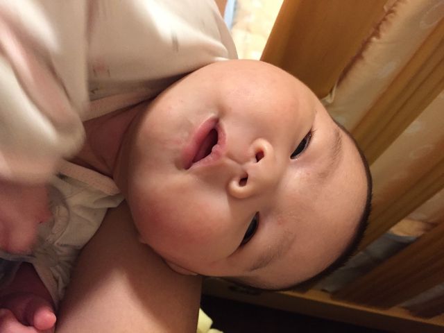 我家寶寶母乳搭水解1還是白白胖胖的～營養應該不會不夠
