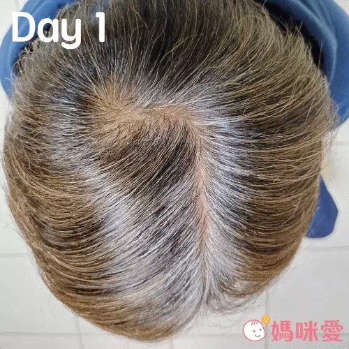 最高現折$600!!【髮速黑｜美吾髮植優】孕婦哺乳可用