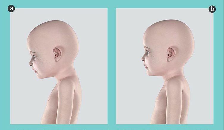 韓國 INUO - 3段可調式水洗枕-洞洞表面-太陽花 (45X33X5cm)-2歲以上適用